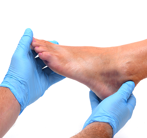 MedCheck Urgent Care Ankle Injury